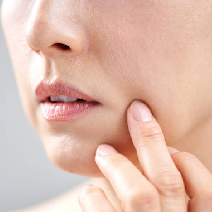 BBLシワ・ほうれい線ケア