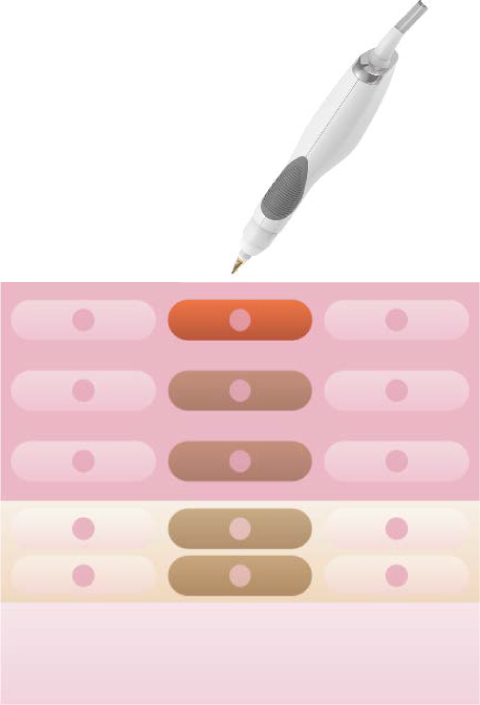 シミケア・シミ改善ステップ1