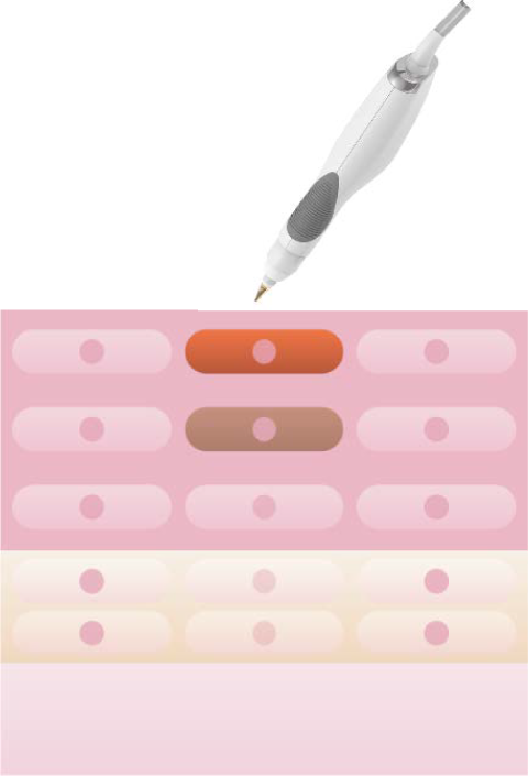 シミケア・シミ改善ステップ3